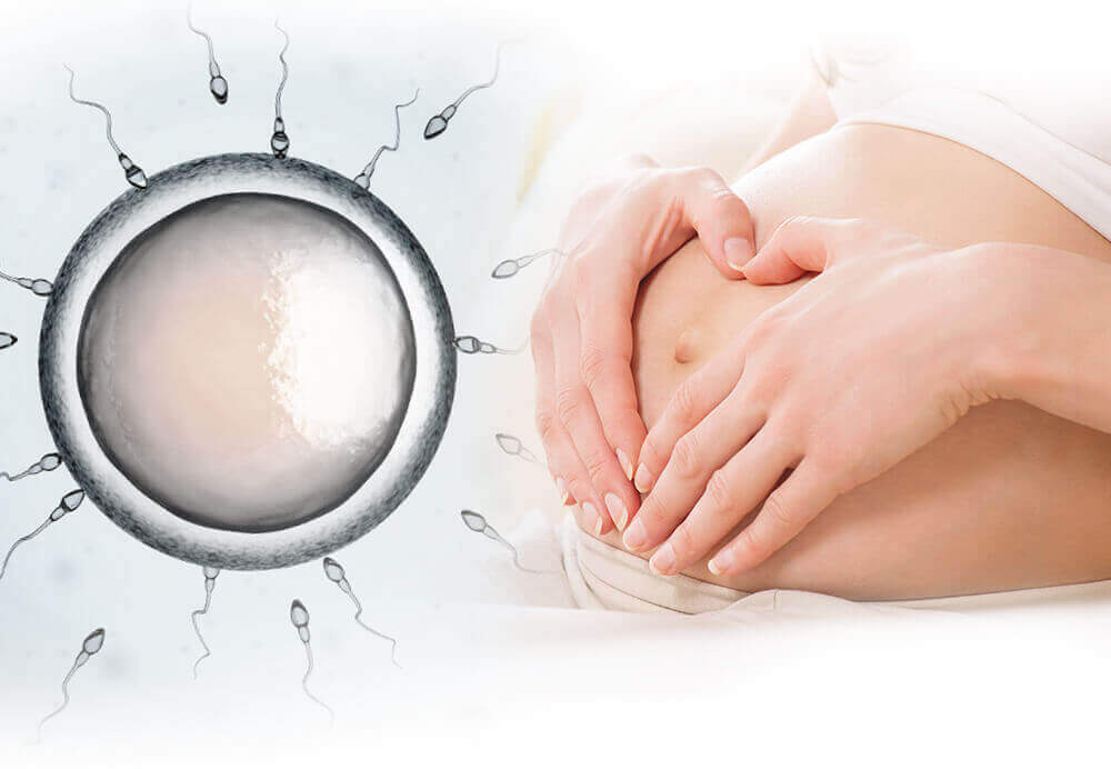 التلقیح داخل الرحم (IUI)