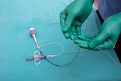 peripheral-angioplasty