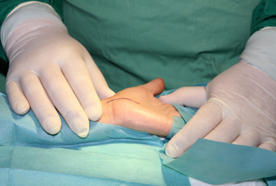 hand-and-wrist-surgery