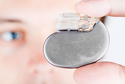 implantable-cardioverter-defibrillator-surgery